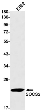 SOCS2 Rabbit mAb