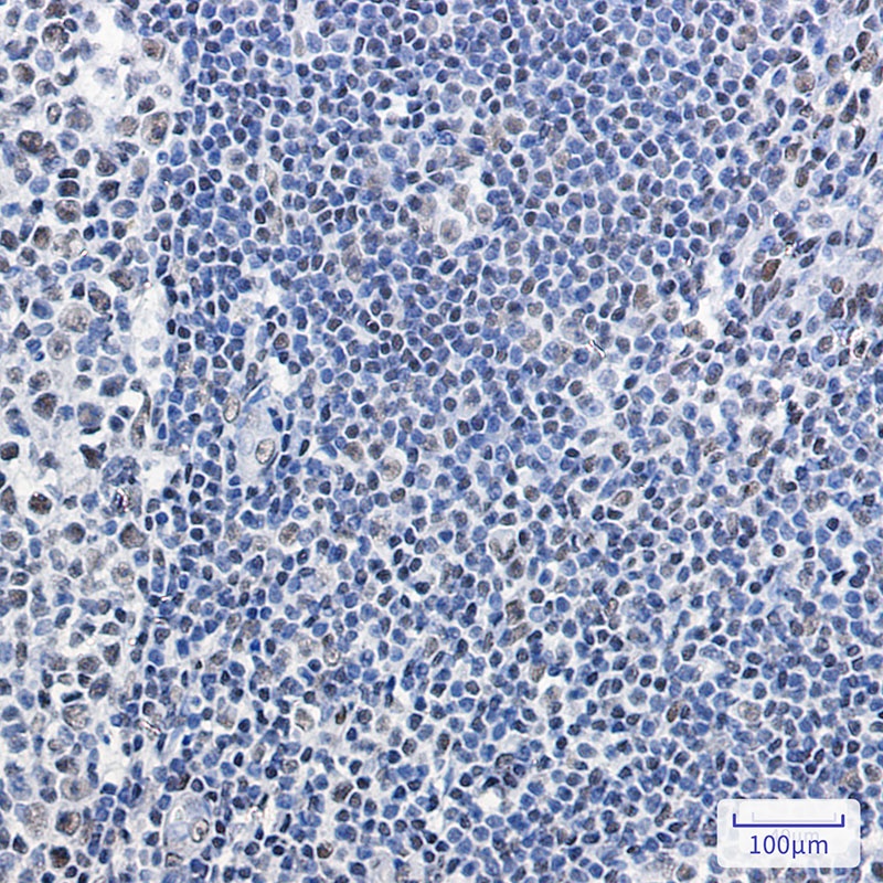 SMARCB1 Antibody