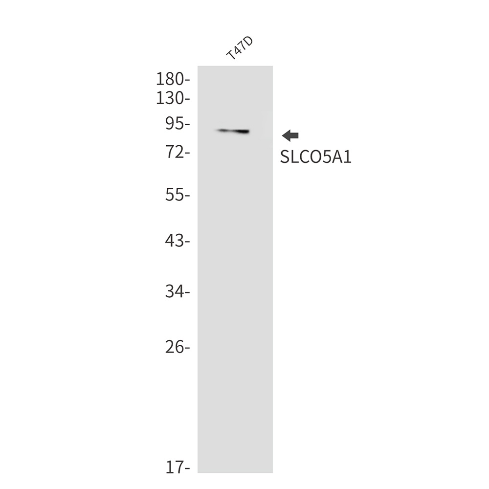 SLCO5A1 Rabbit mAb