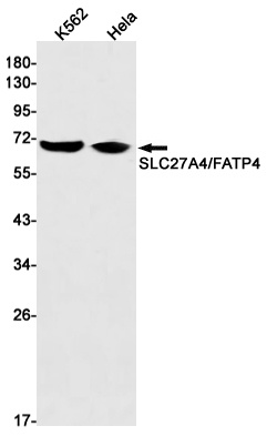 SLC27A4 Antibody