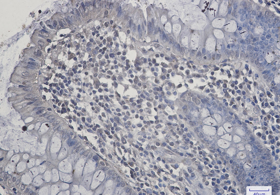 SIRT2 Rabbit mAb