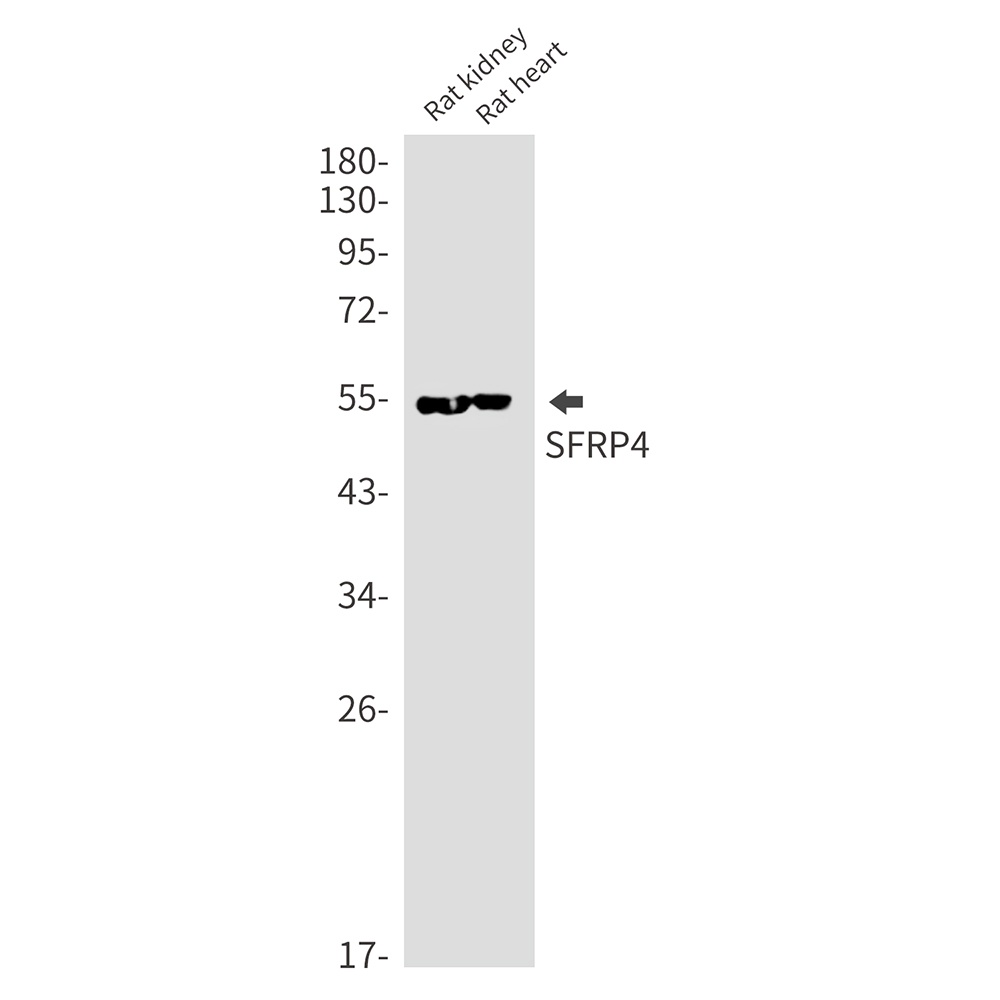 SFRP4 Rabbit mAb