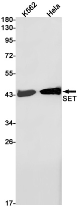 SET Rabbit mAb