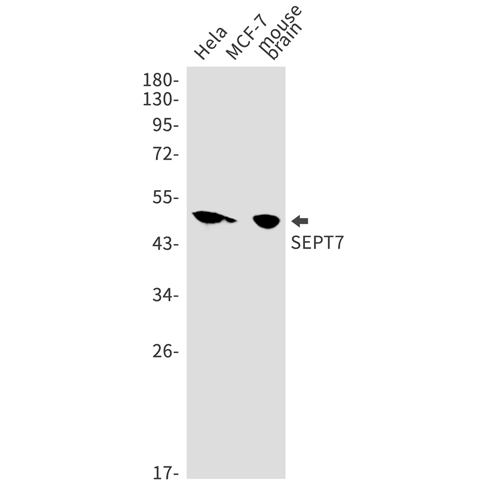 Septin 7 Rabbit mAb