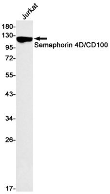 Semaphorin 4D Rabbit mAb