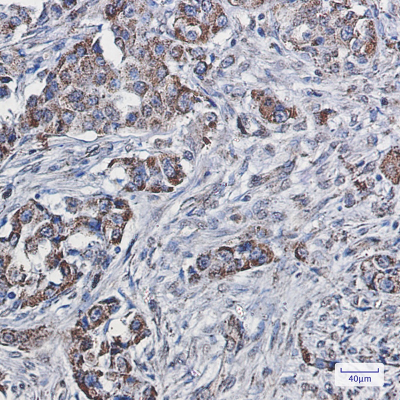 SEC61A Rabbit mAb