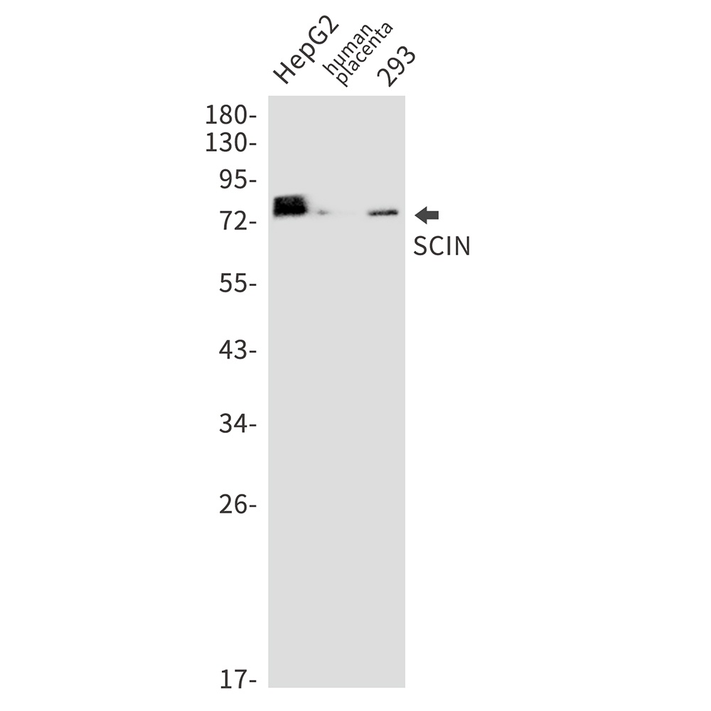 SCIN Rabbit mAb