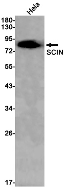 SCIN Rabbit mAb