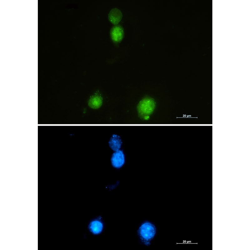 SAFB Antibody