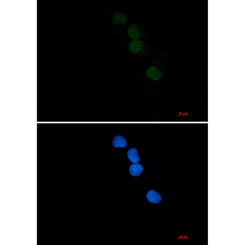 SAE1 Rabbit mAb