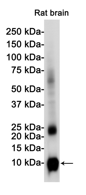 S100B Rabbit mAb