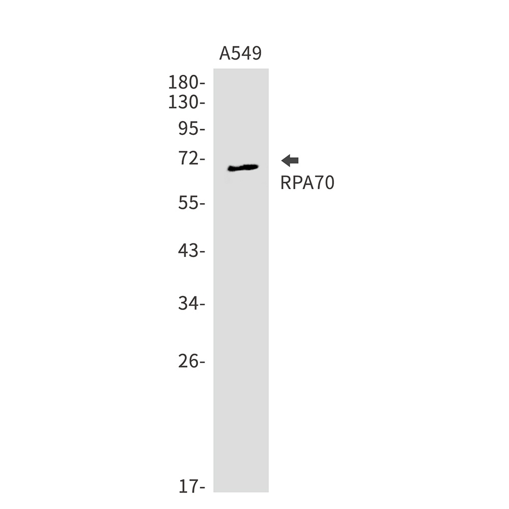 RPA1 Antibody
