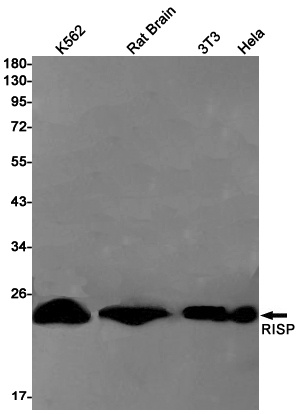 Complex III Subunit 5 Rabbit mAb