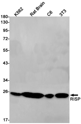 Complex III Subunit 5 Rabbit mAb