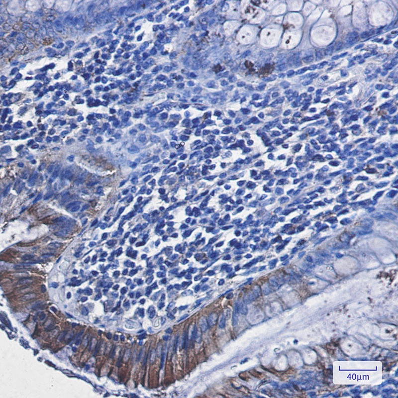RAVER2 Rabbit mAb