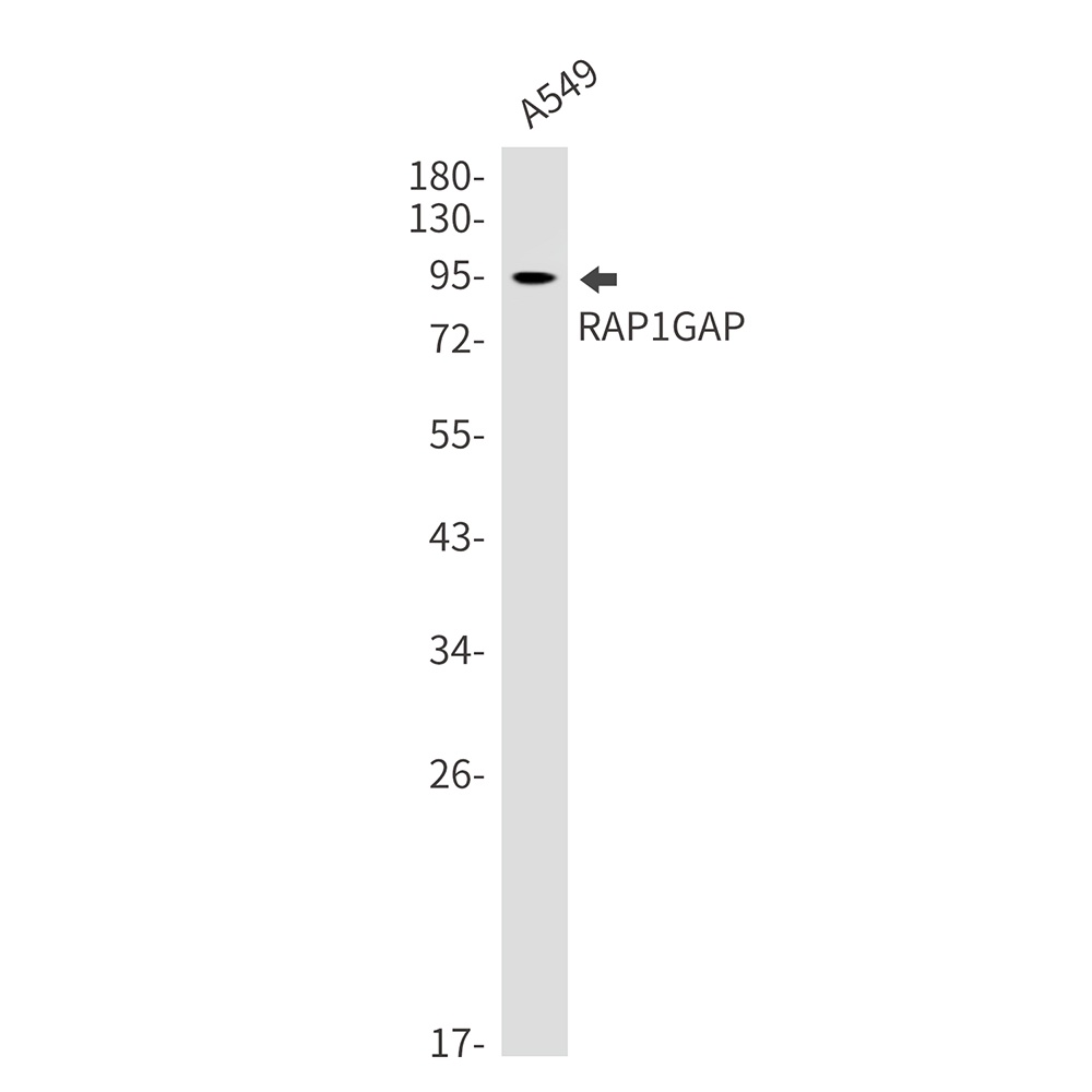 RAP1GAP Rabbit mAb