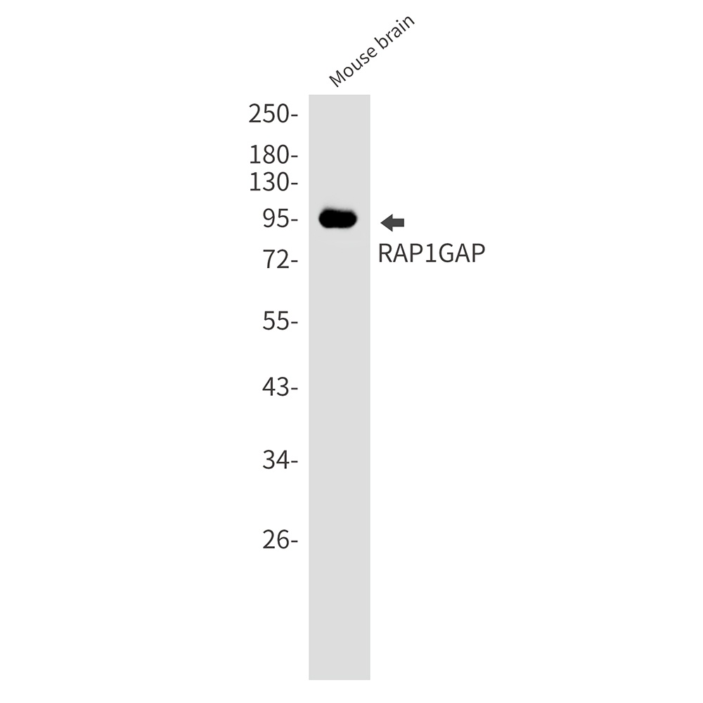 RAP1GAP Rabbit mAb