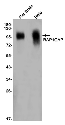 RAP1GAP Rabbit mAb