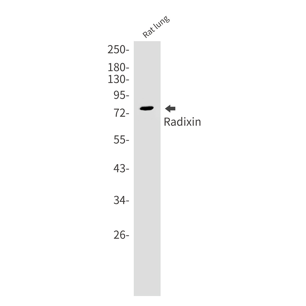 Radixin Rabbit mAb