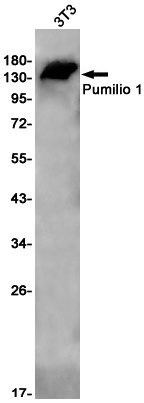 PUM1 Rabbit mAb