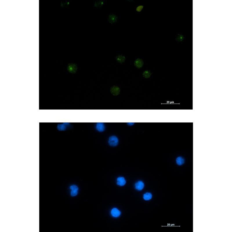 PSF1 Rabbit mAb