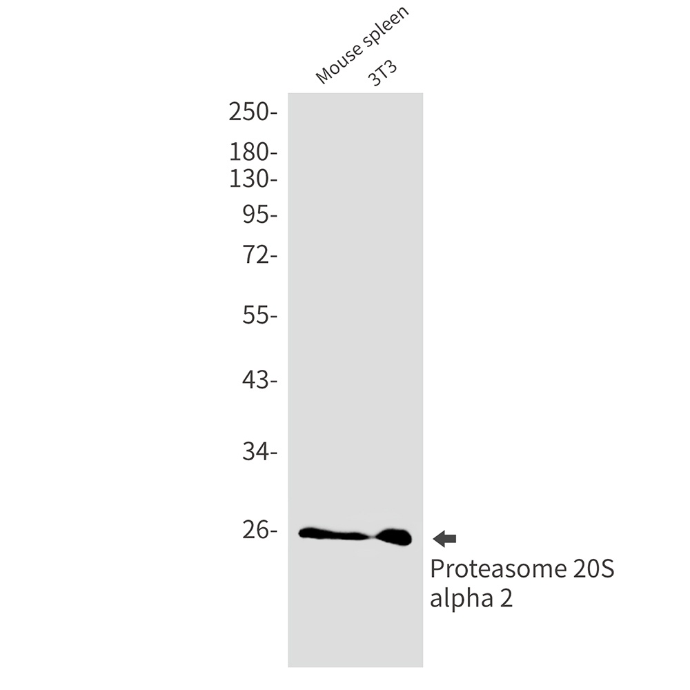 Proteasome alpha 2 Rabbit mAb