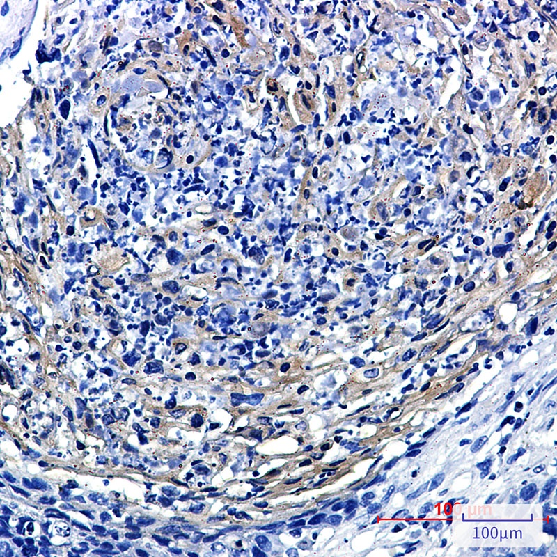 PRMT3 Rabbit mAb