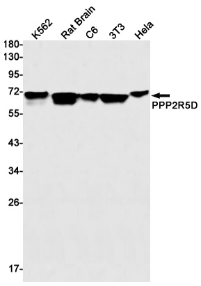 PPP2R5D Rabbit mAb