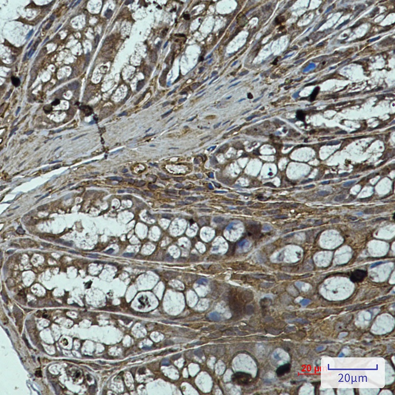 PPP1CA Antibody