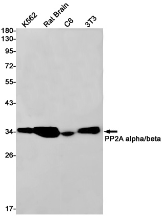PP2A alpha/beta Rabbit mAb
