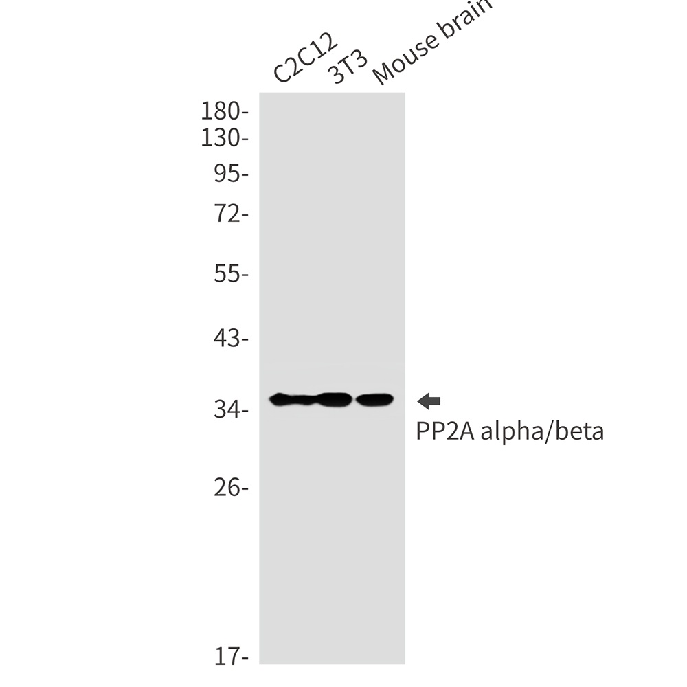 PP2A alpha/beta Rabbit mAb