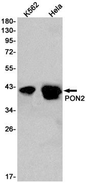 PON2 Rabbit mAb