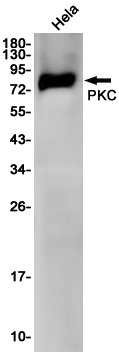 PKC gamma Rabbit mAb