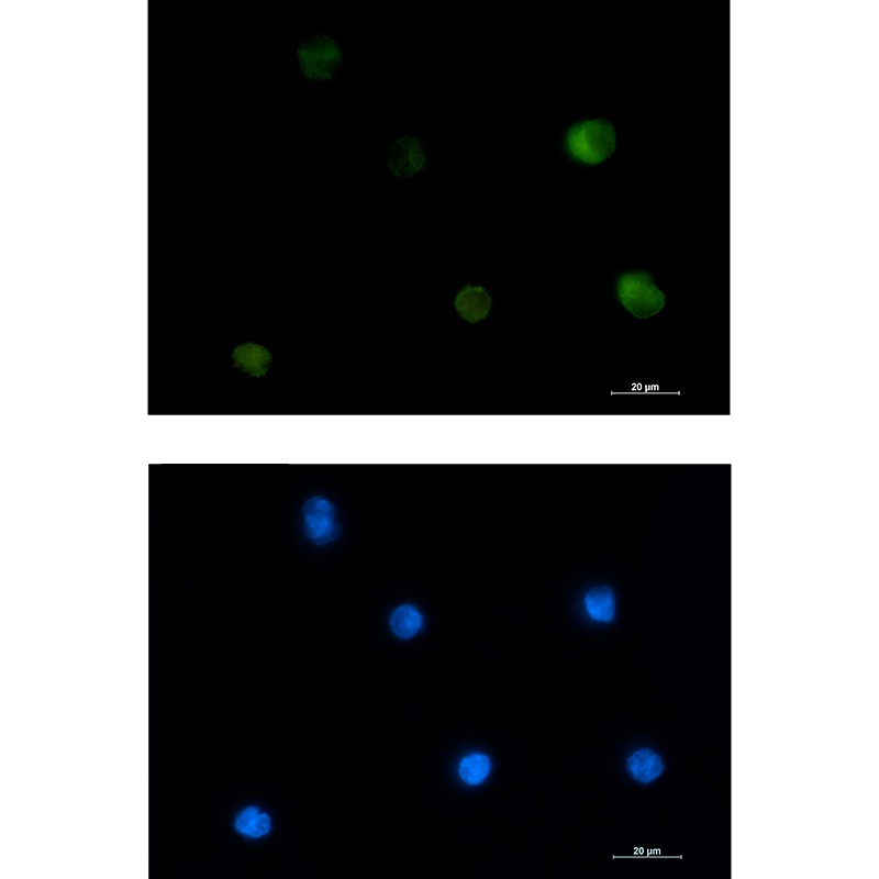 PKC beta 2 Rabbit mAb