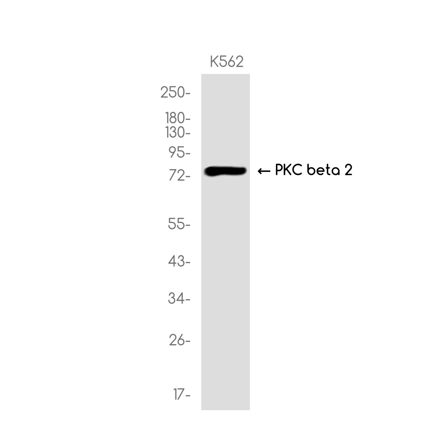PKC beta 2 Rabbit mAb