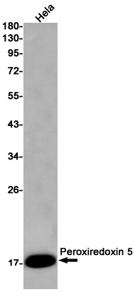 Peroxiredoxin 5 Rabbit mAb