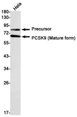 PCSK9 Antibody