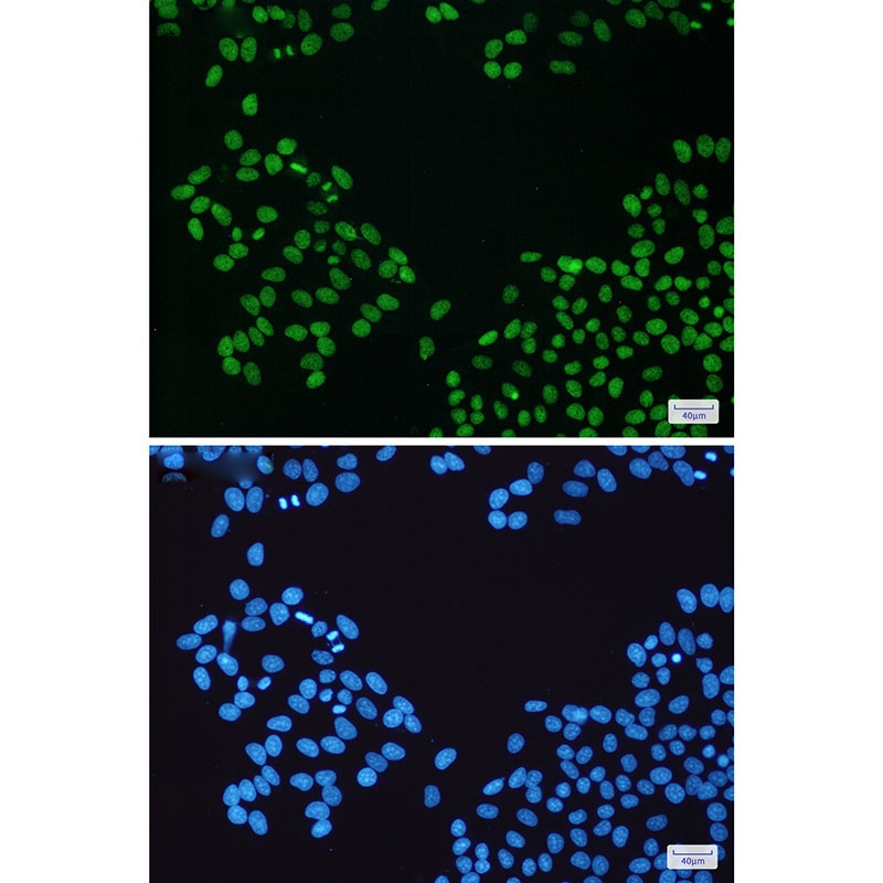 PARP1 Rabbit mAb