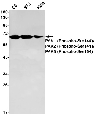 PAK3 Antibody