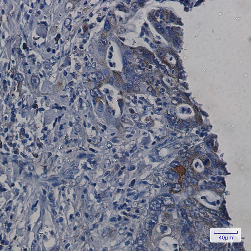 ORP150 Rabbit mAb