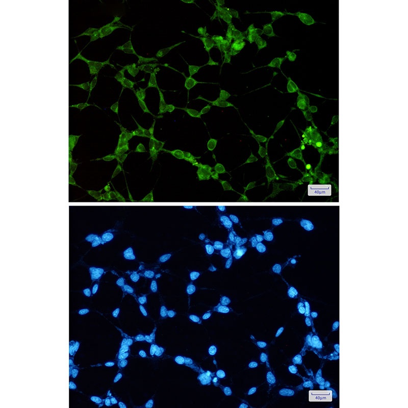 ORP1 Rabbit mAb