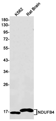 NDUFB4 Rabbit mAb