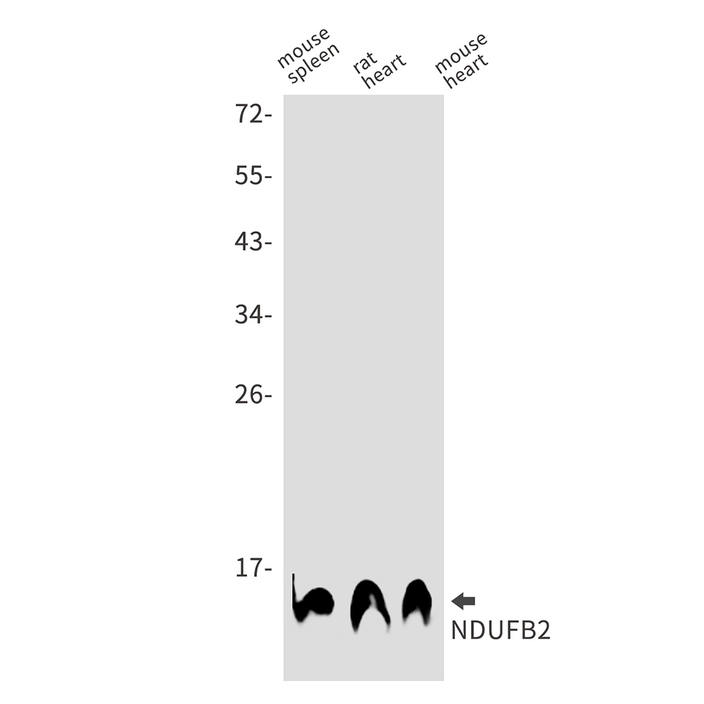 NDUFB2 Rabbit mAb