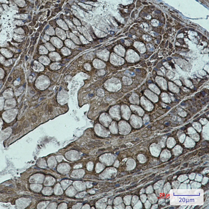 NDUFB11 Rabbit mAb