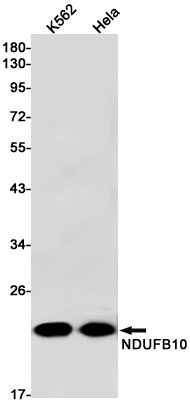 NDUFB10 Antibody