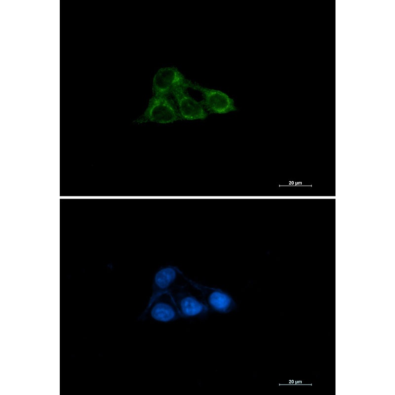 NDUFAF4 Rabbit mAb