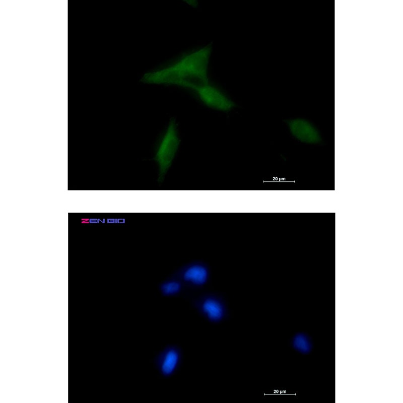 NDUFAF1 Antibody