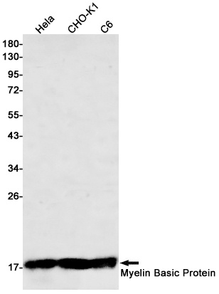 Myelin Basic Protein Rabbit mAb