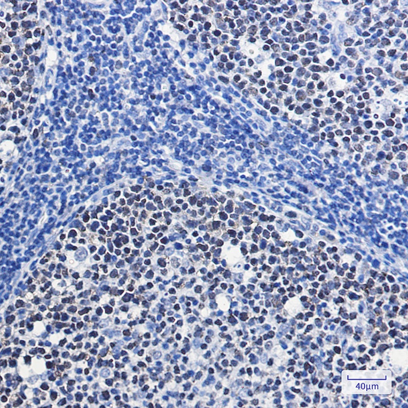 MCM7 Rabbit mAb