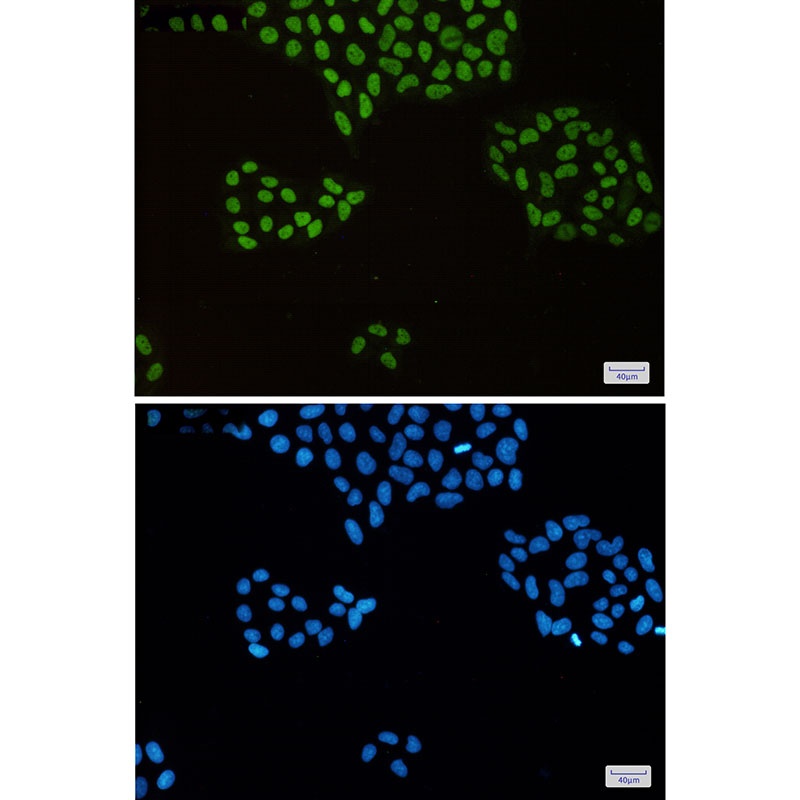 MCM2 Rabbit mAb